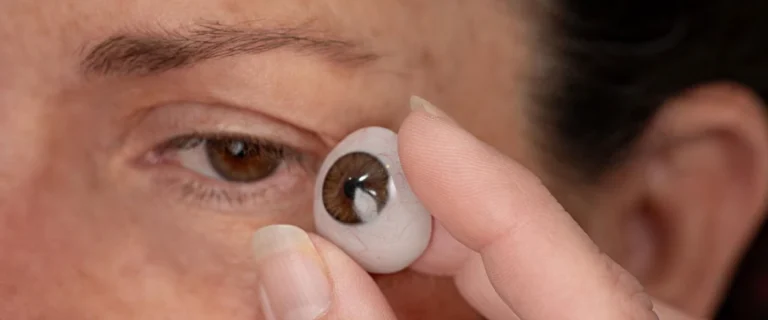 Prótesis ocular realista utilizada para rehabilitación estética en pacientes