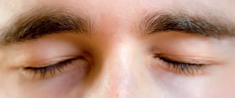 Temblor involuntario en los ojos conocido como miokimia palpebral